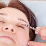 Eyelid Surgery at FacesFirst