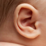 EarWell or Otoplasty? Which is Right for My Child?