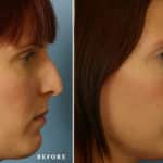 FACE-nose2