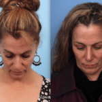 BeforeAfter-2-1024×765