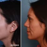 FACE-Nose_LR1