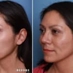 FACE-Nose_LR2