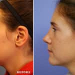 FACE-Nose_k1