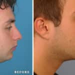 FACE-chinaugmentation-9