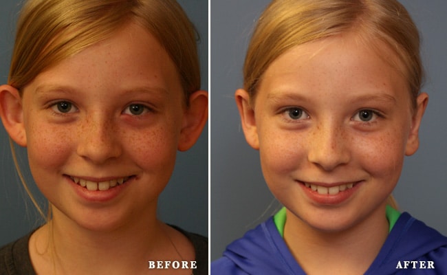 before_after_img