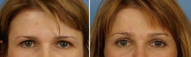 before_after_img
