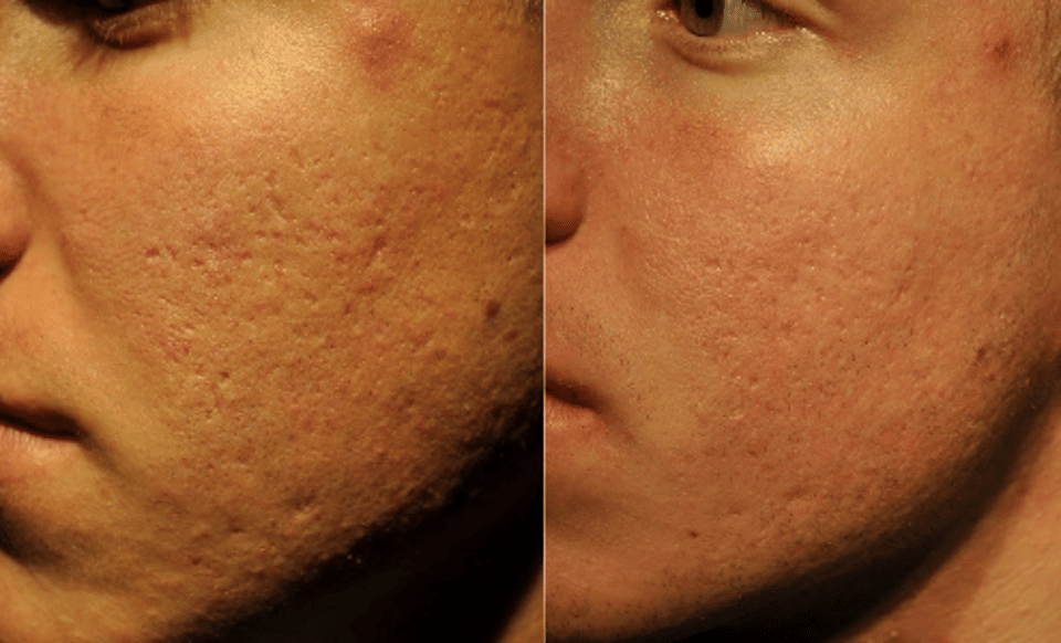 before_after_img