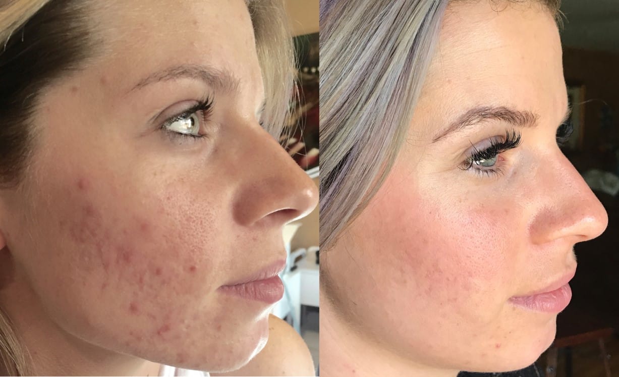before_after_img
