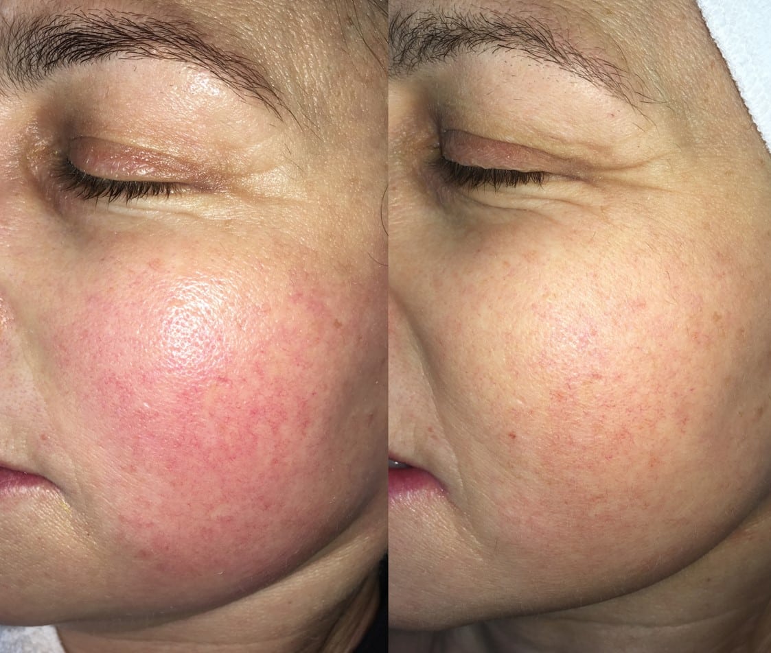 before_after_img