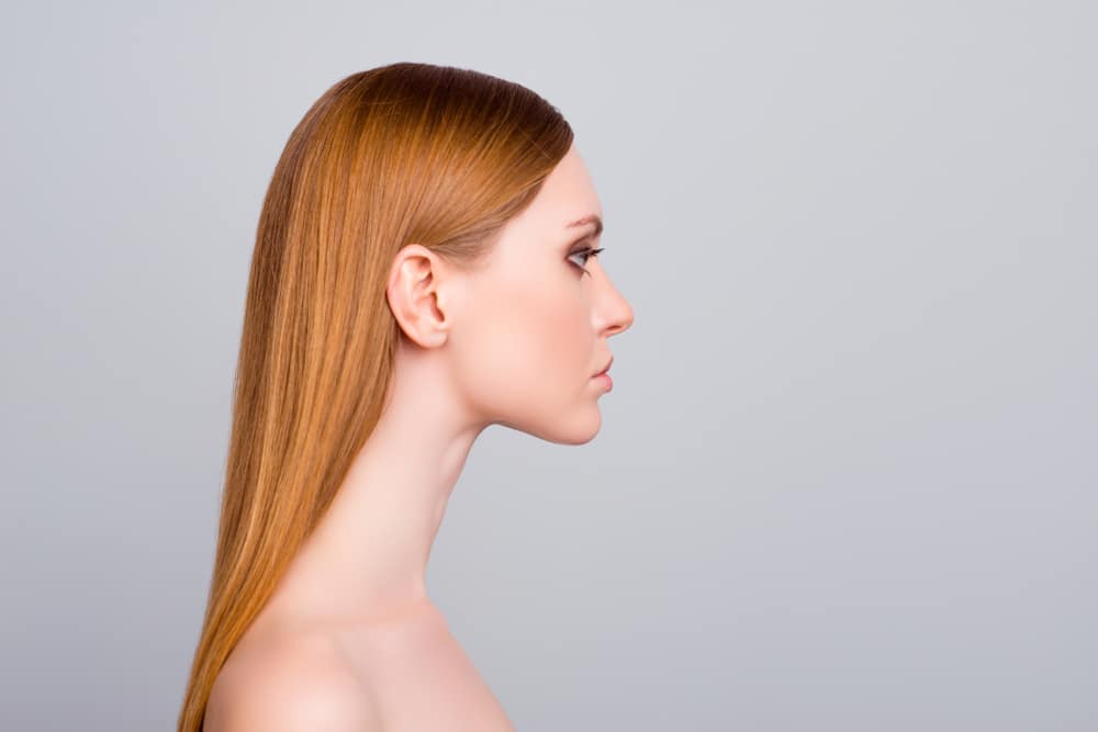 How Do You Know If You Need a Neck Lift?