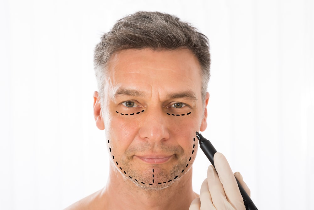 When is the Right Time to Get a Facelift?