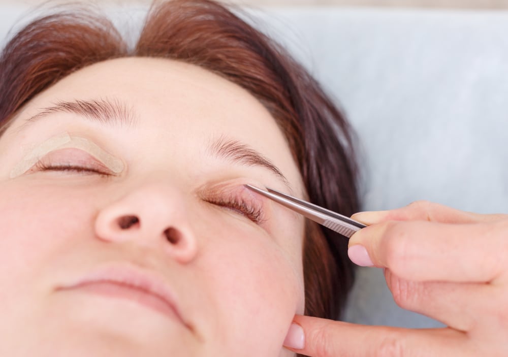 Eyelid Surgery at Faces First