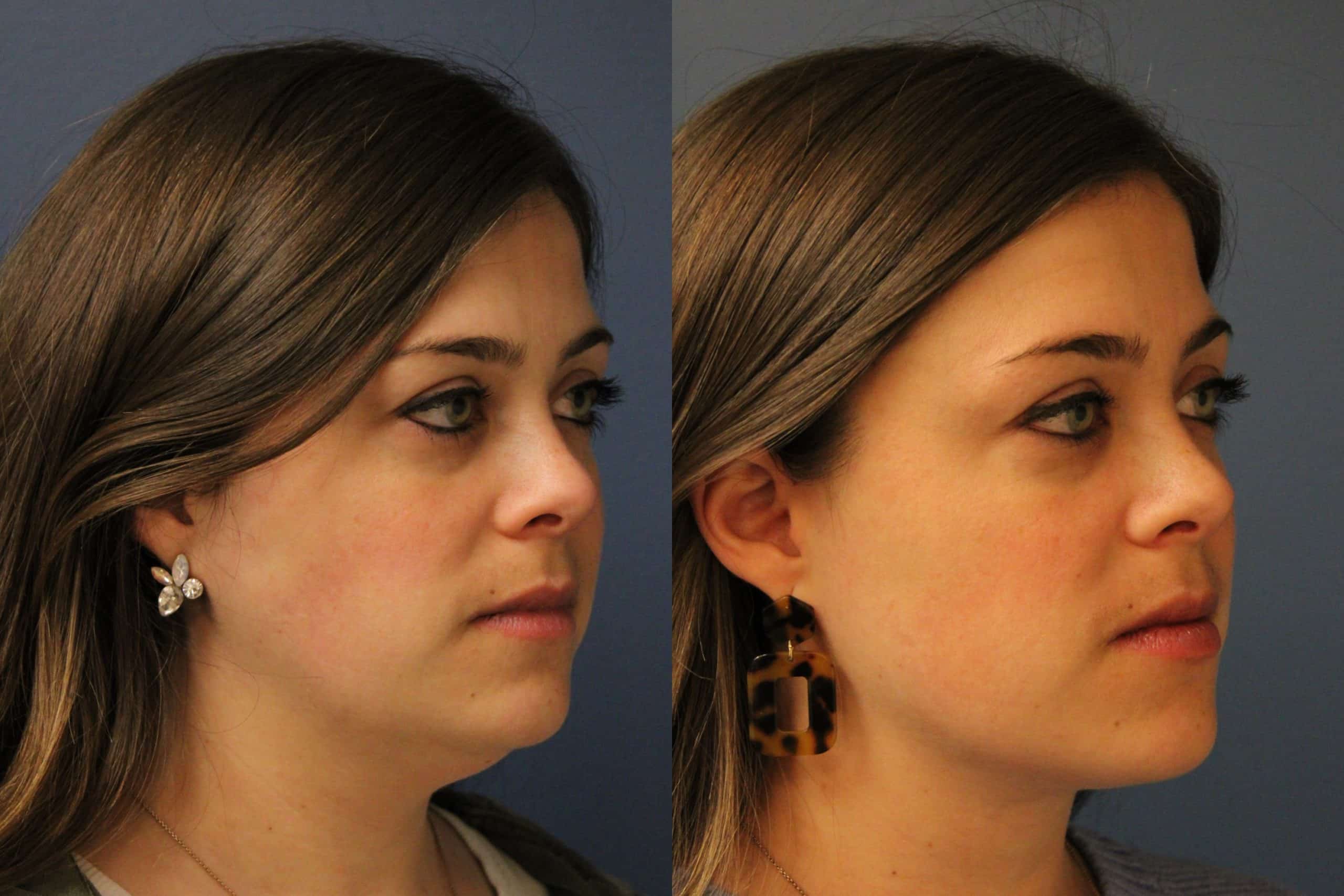 before_after_img