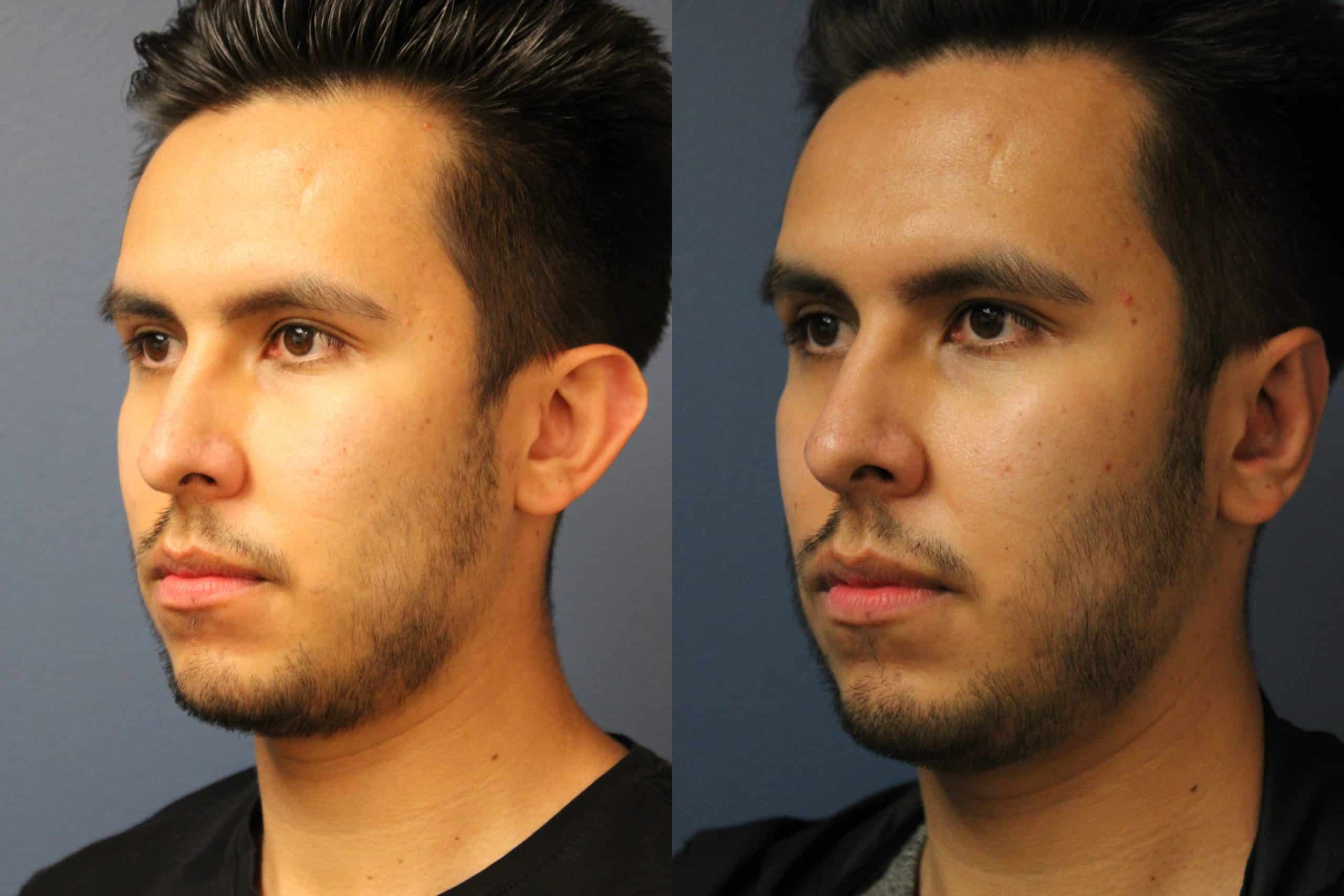 before_after_img
