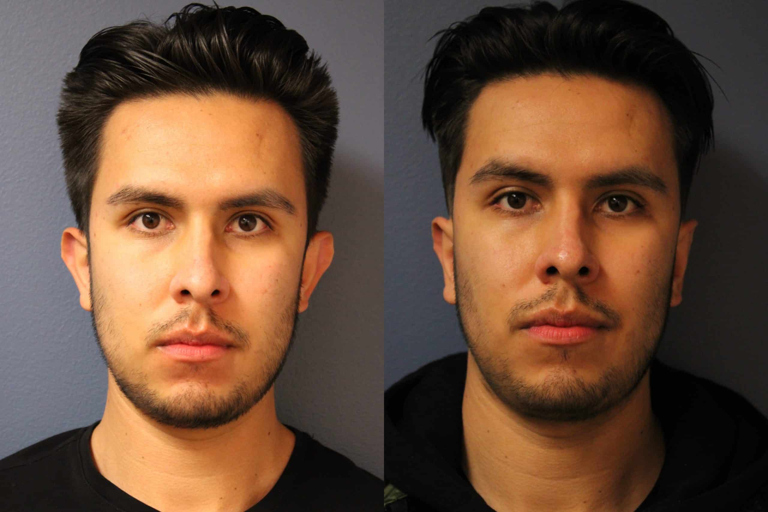 before_after_img