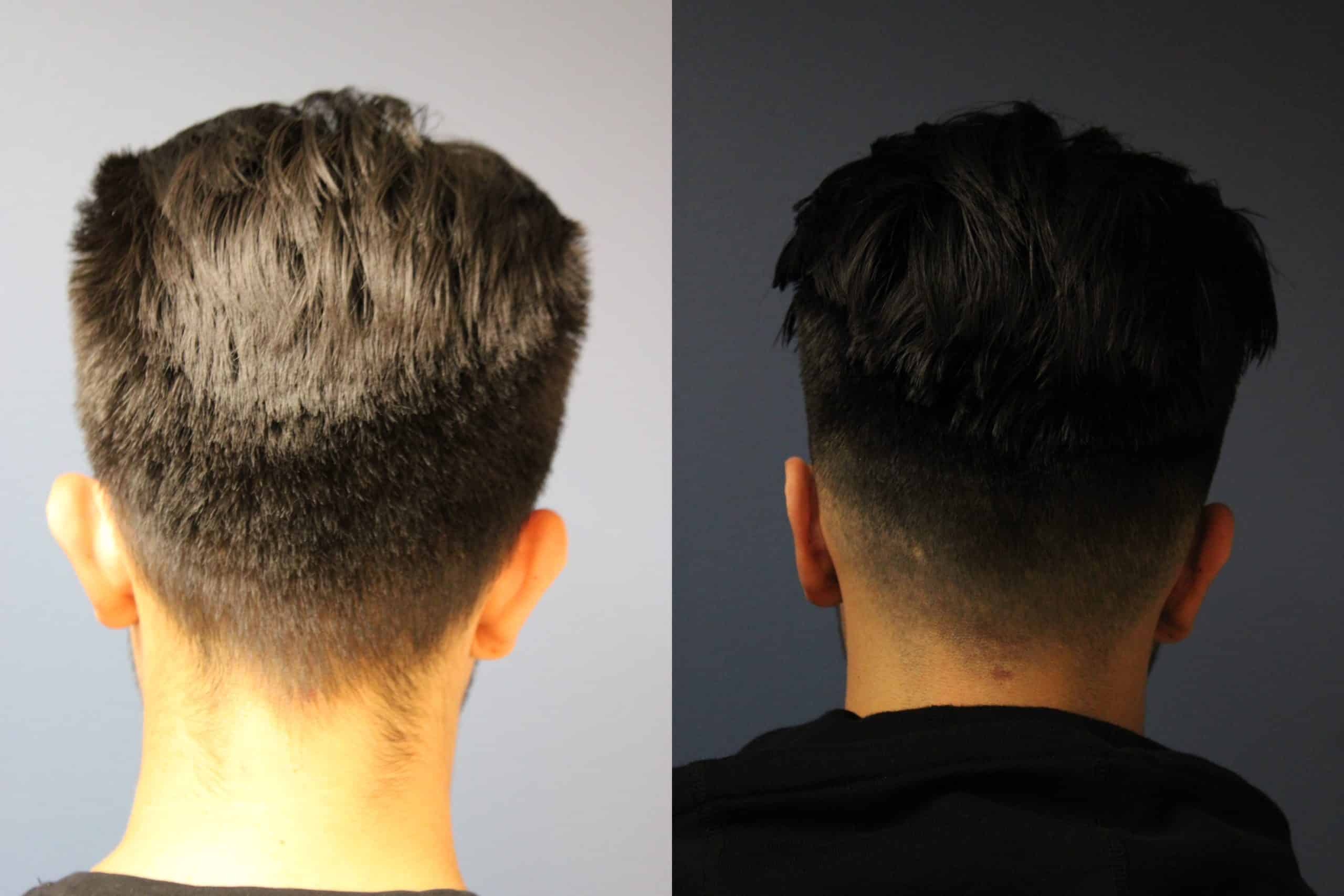 before_after_img