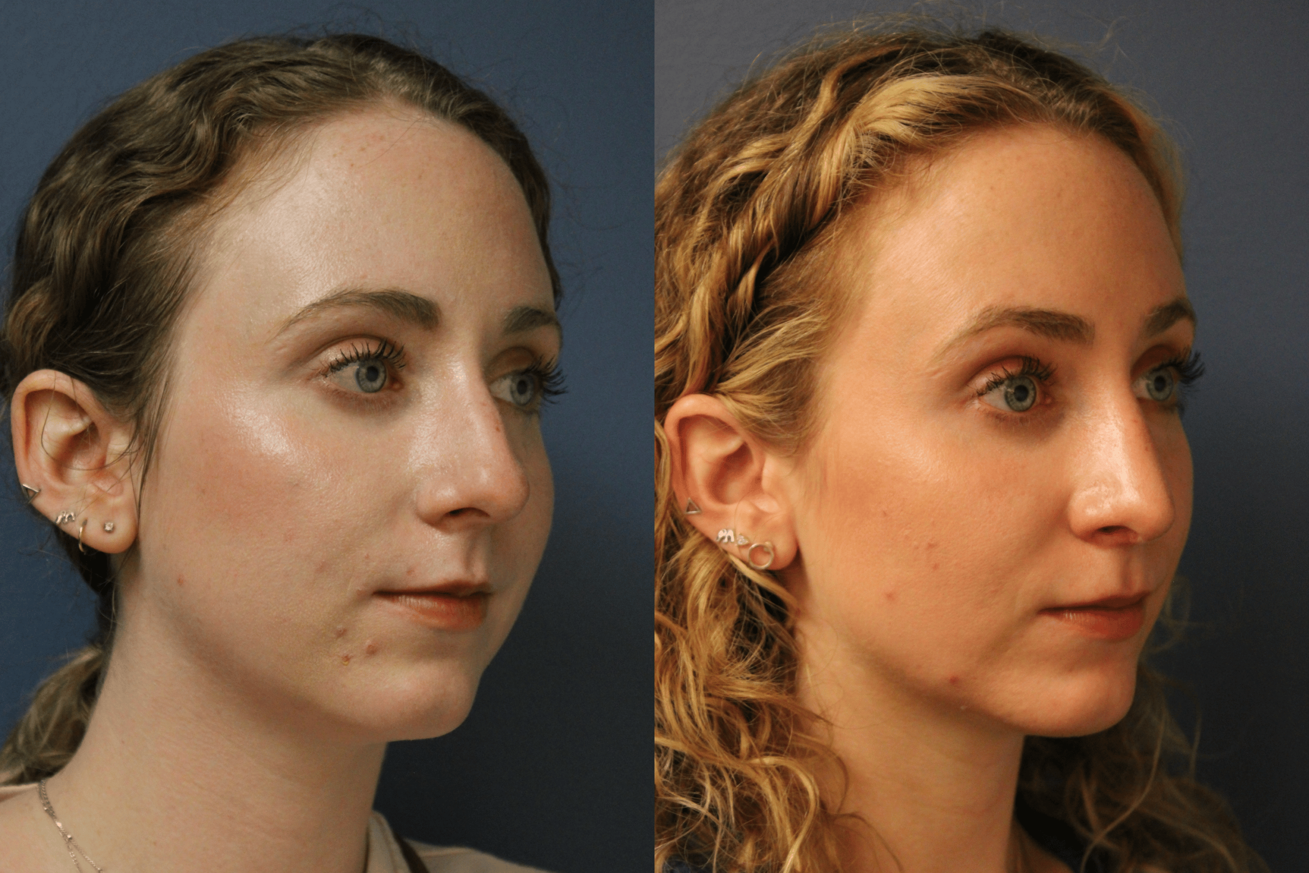 before_after_img