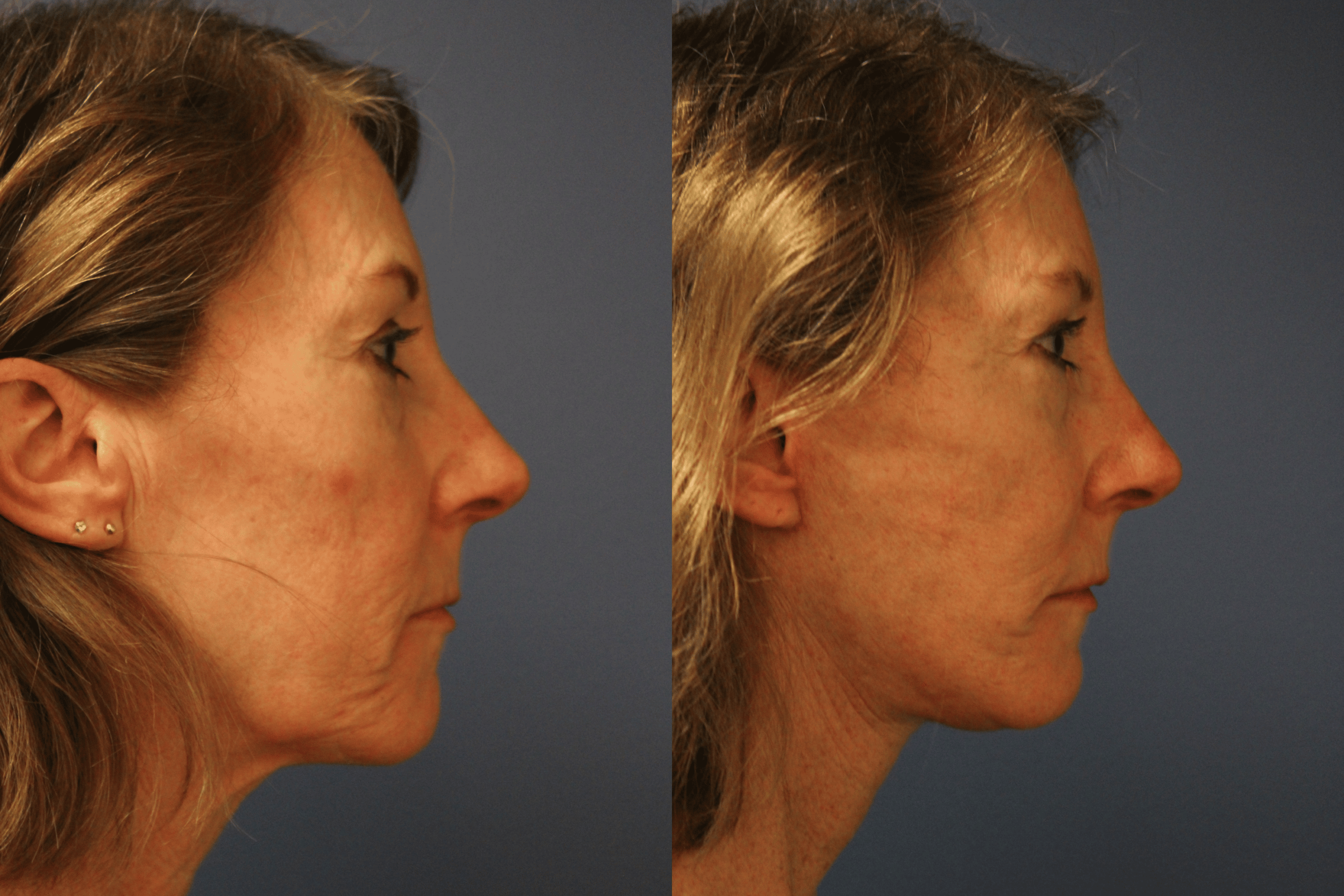 before_after_img