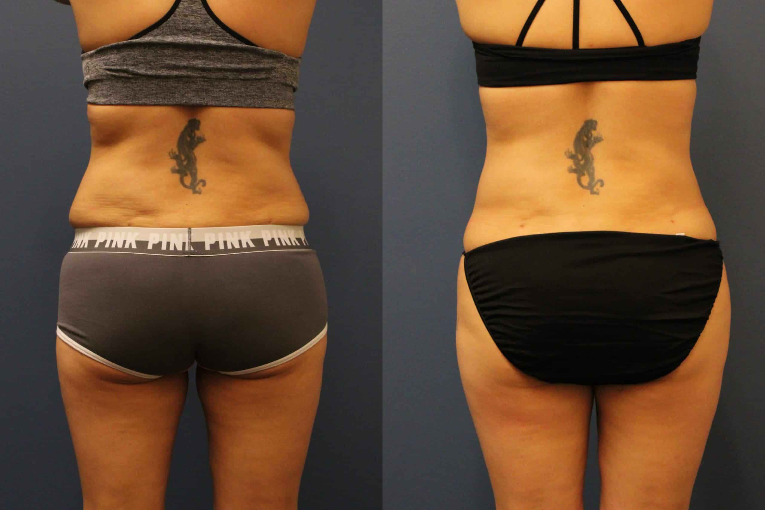 before_after_img