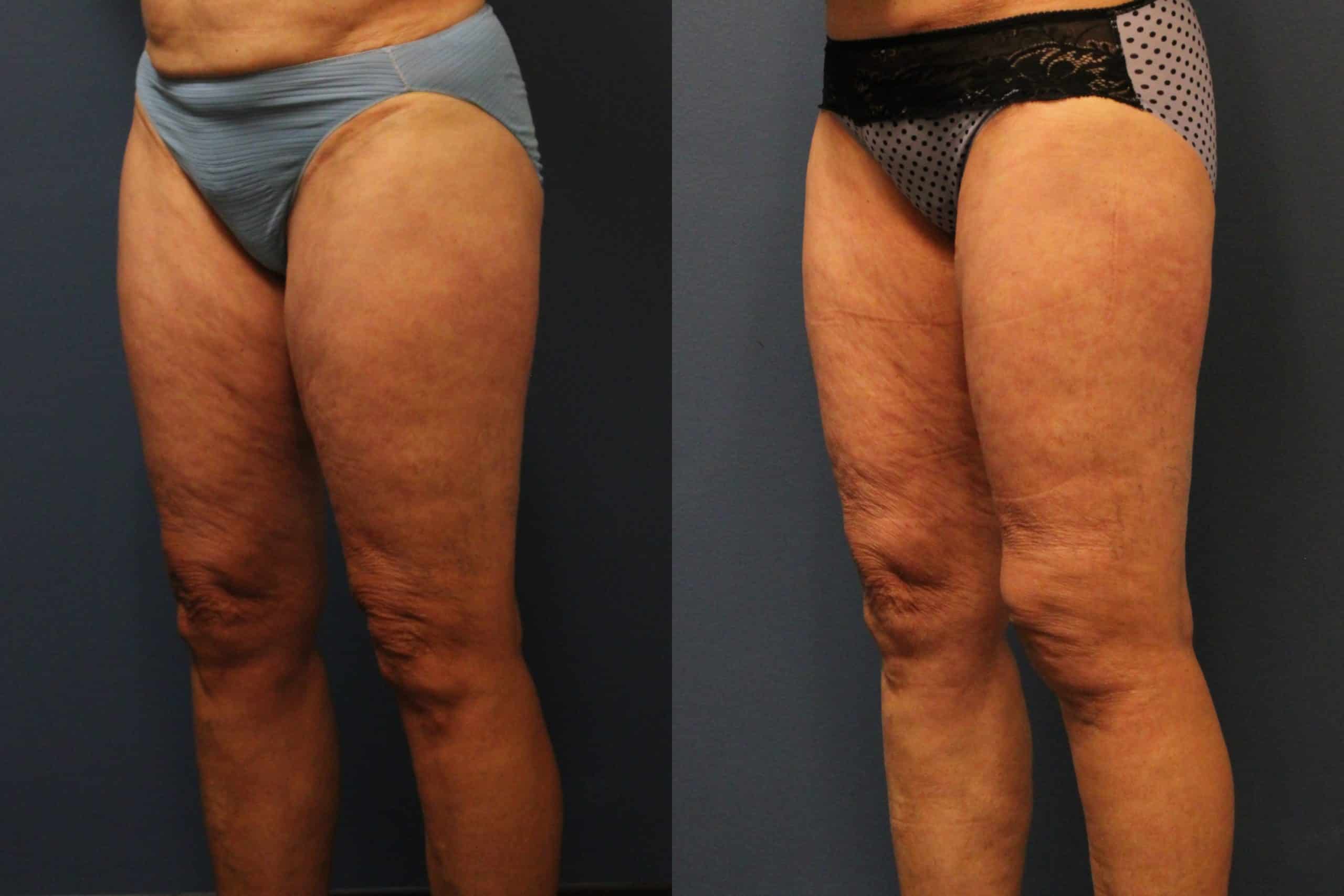 before_after_img