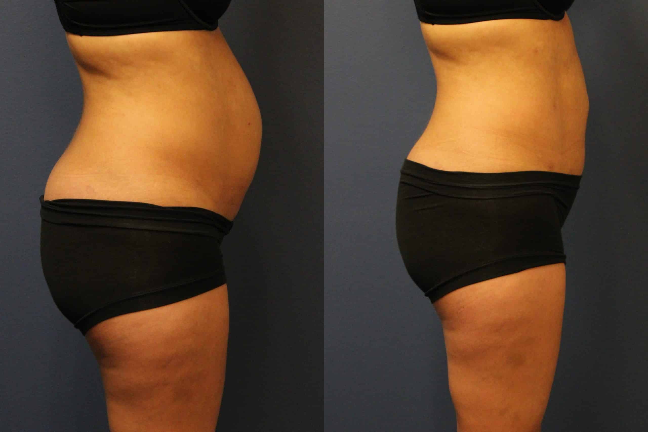 before_after_img