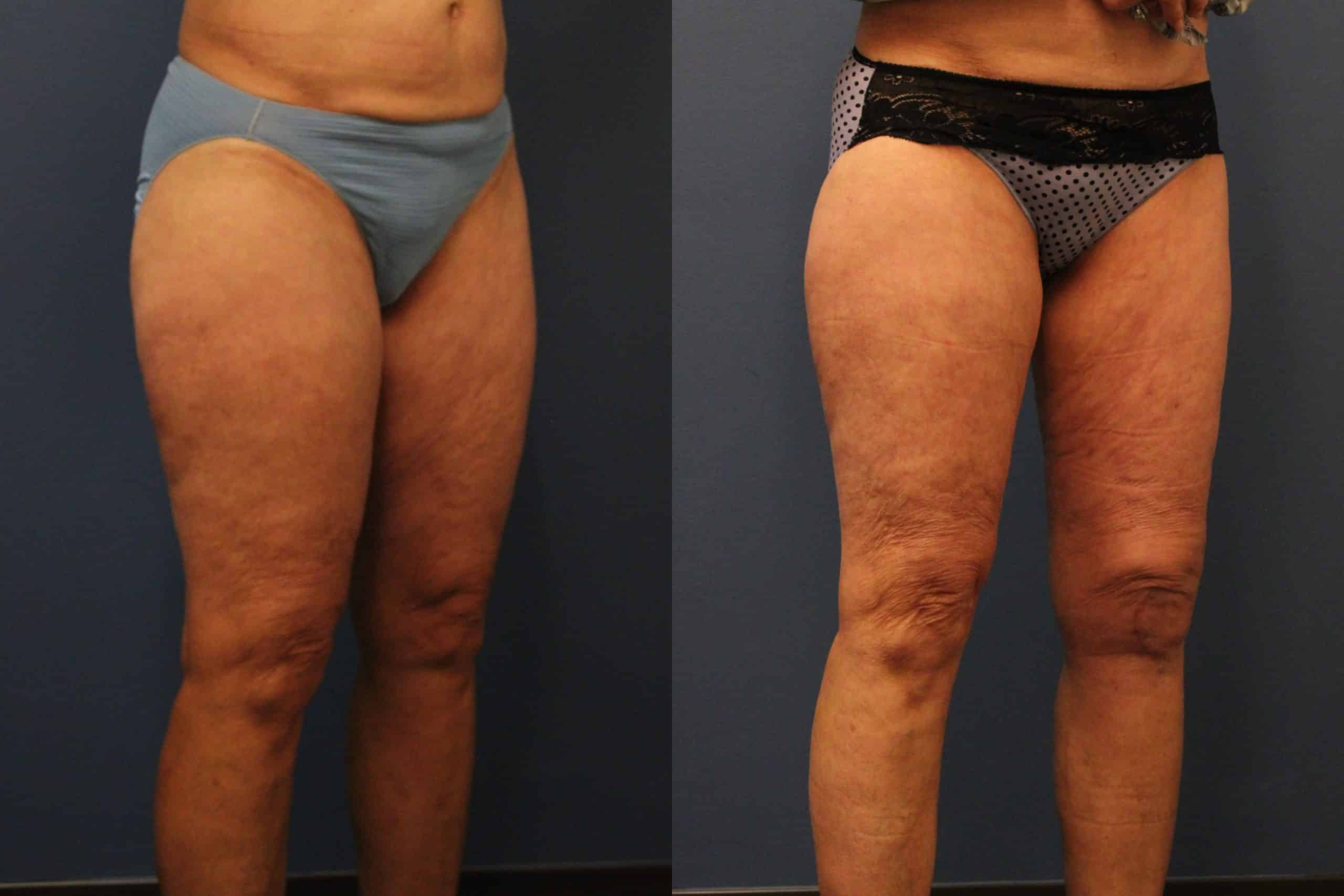 before_after_img