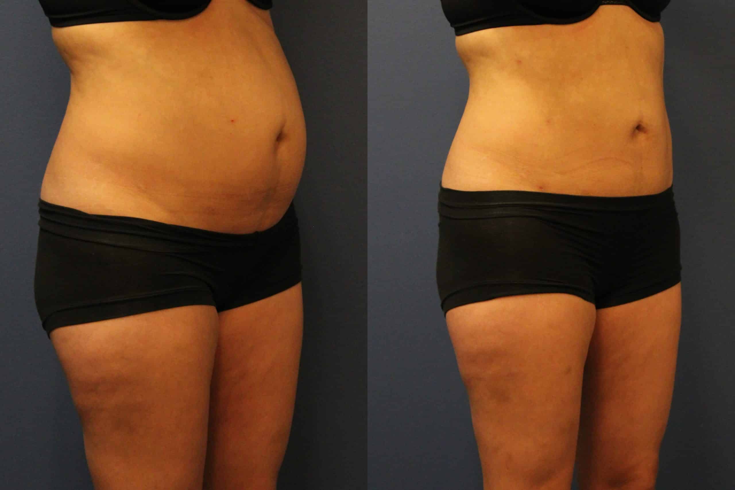 before_after_img