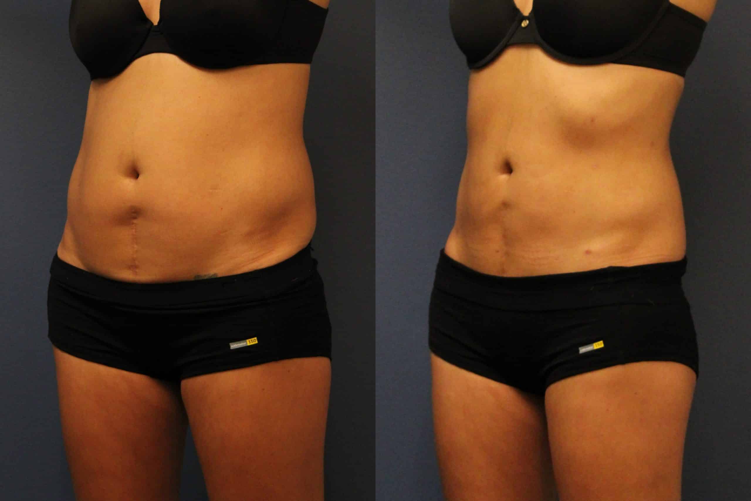 before_after_img