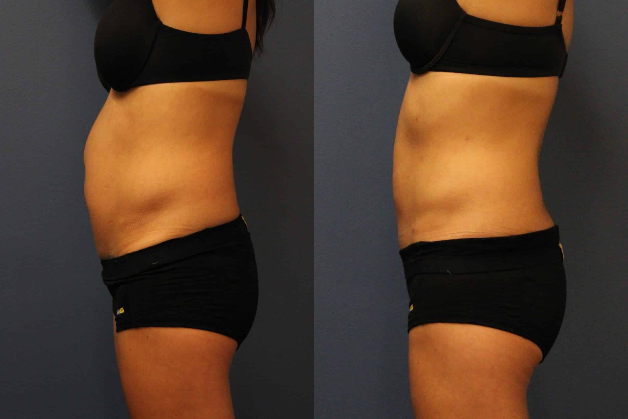 before_after_img