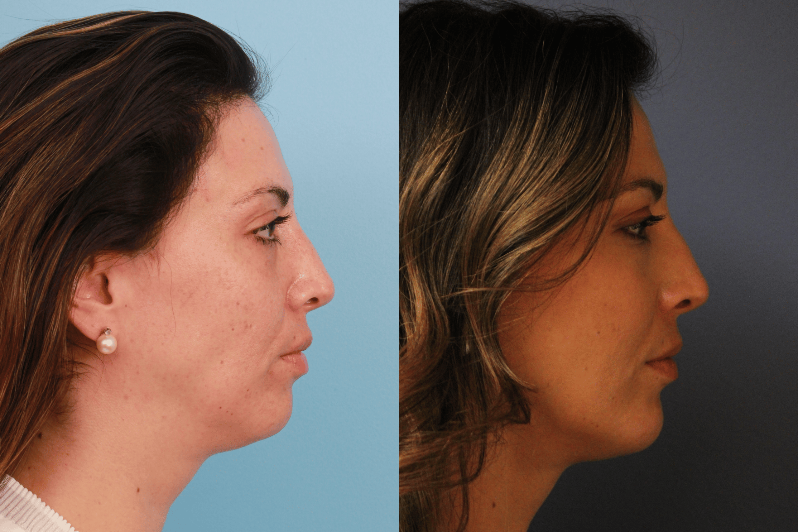 before_after_img