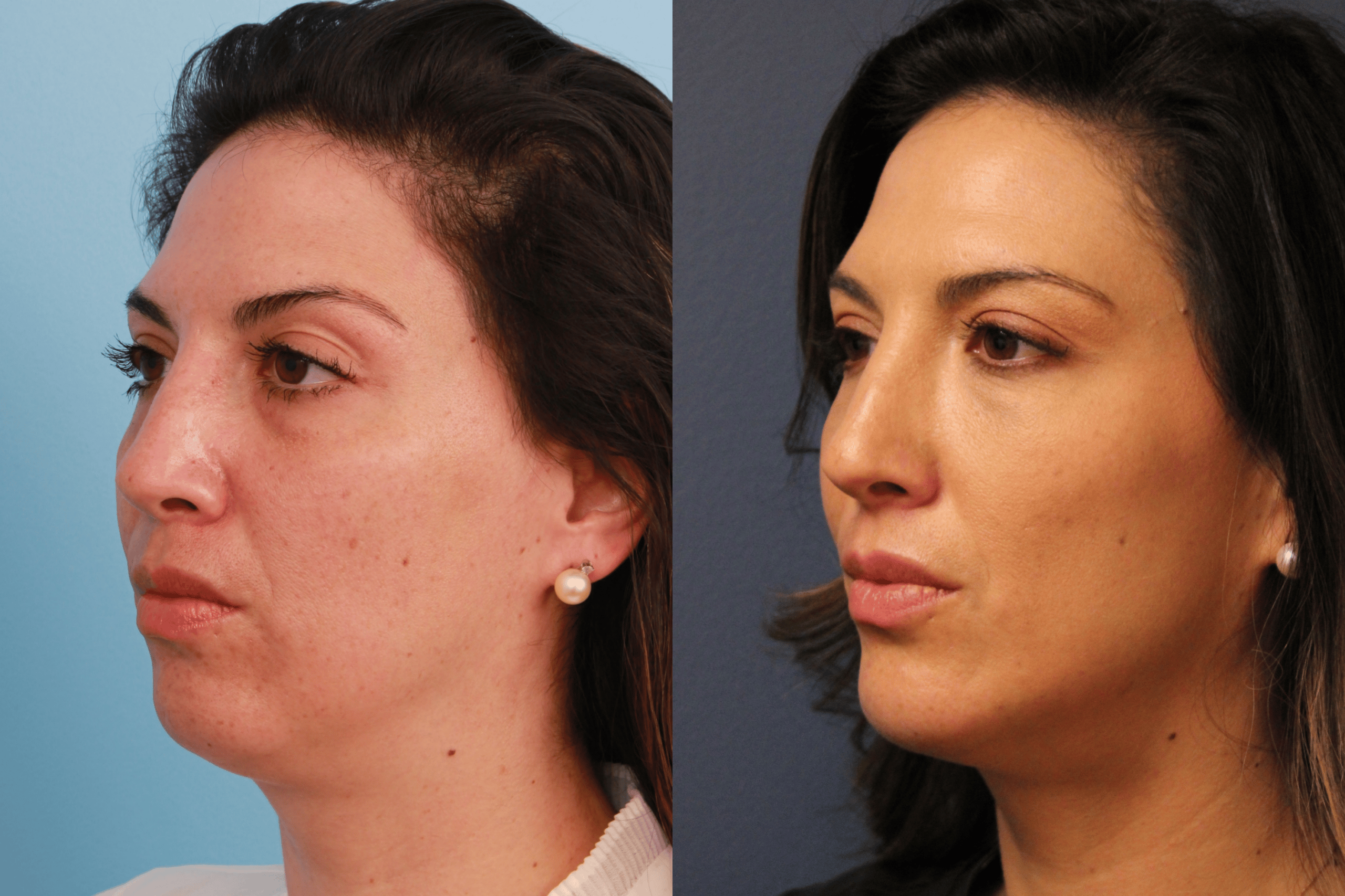 before_after_img