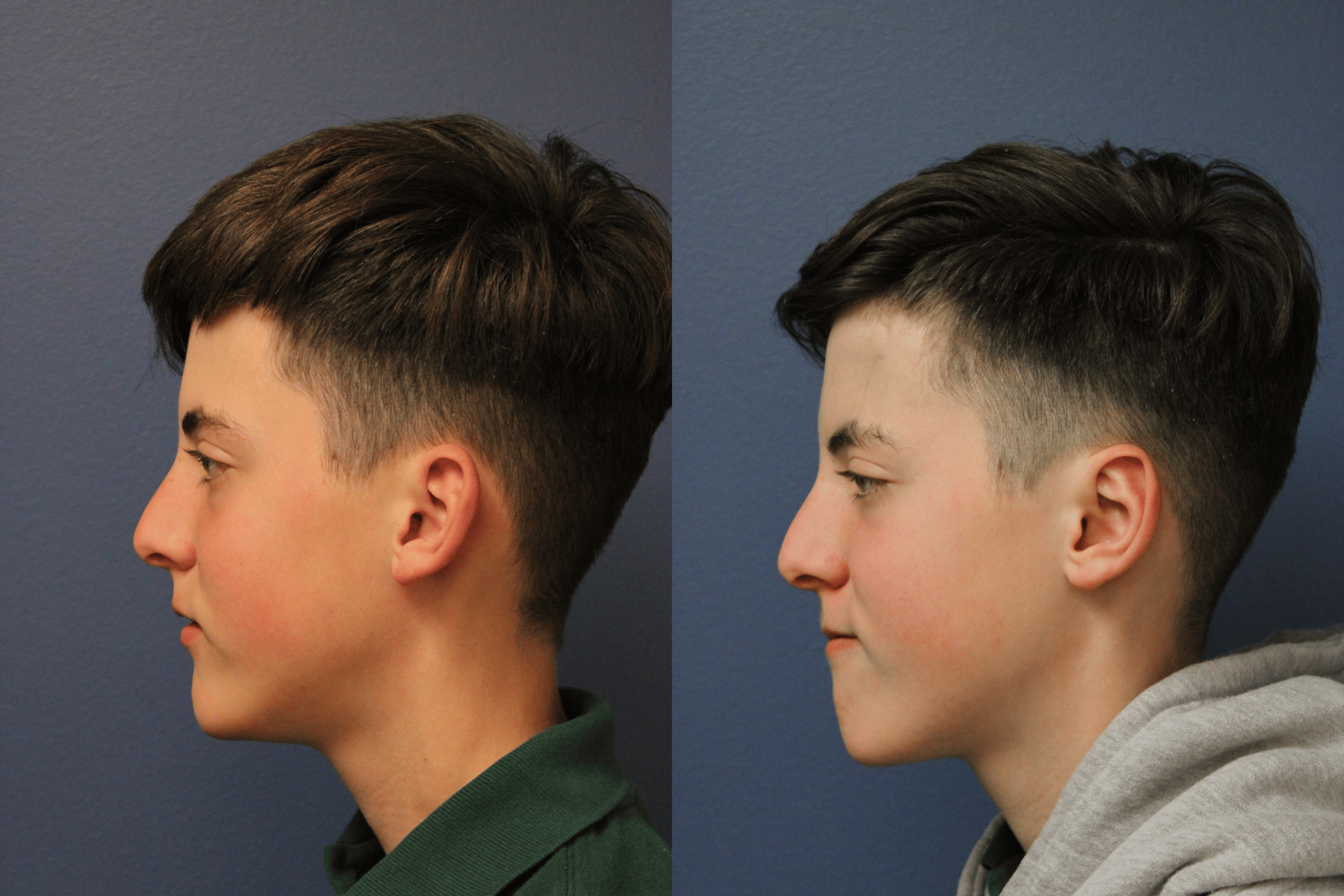 before_after_img