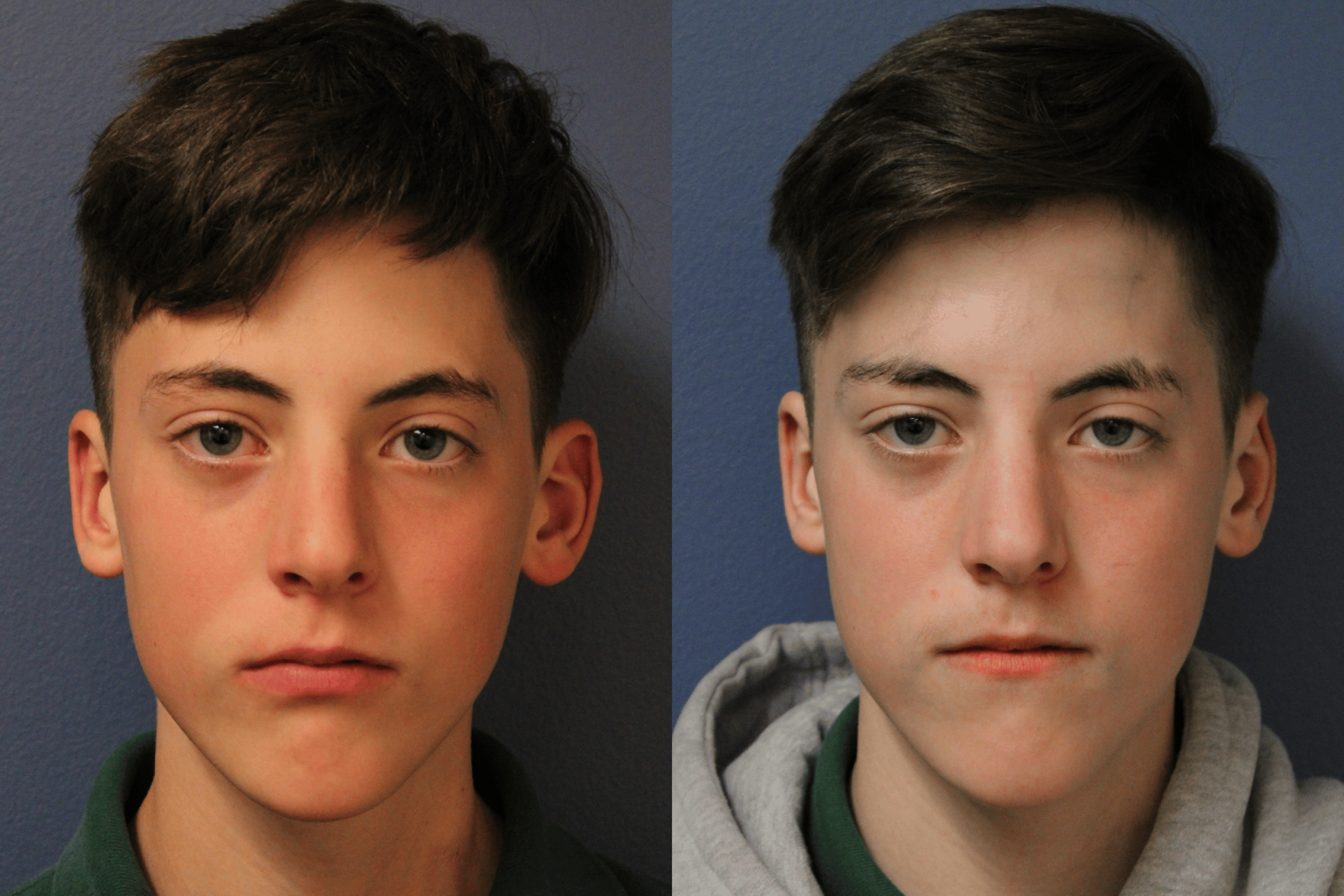 before_after_img