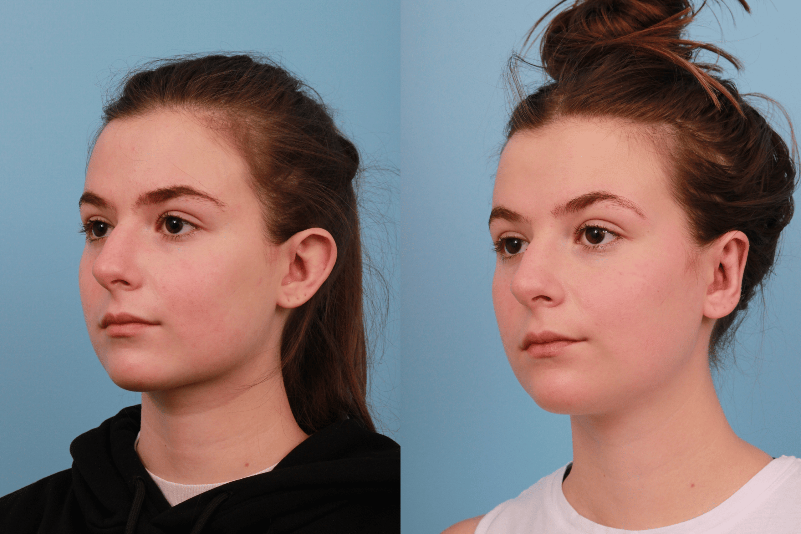 before_after_img