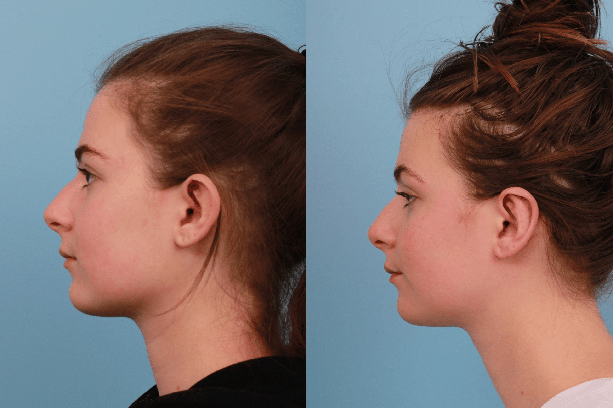 before_after_img