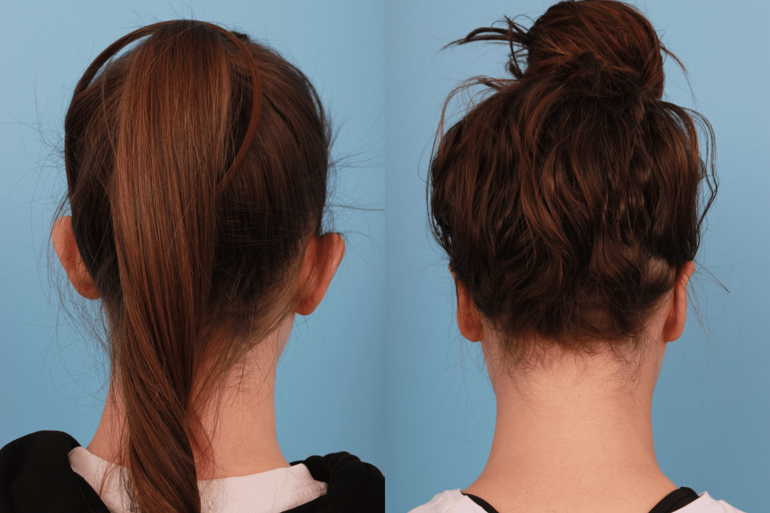 before_after_img