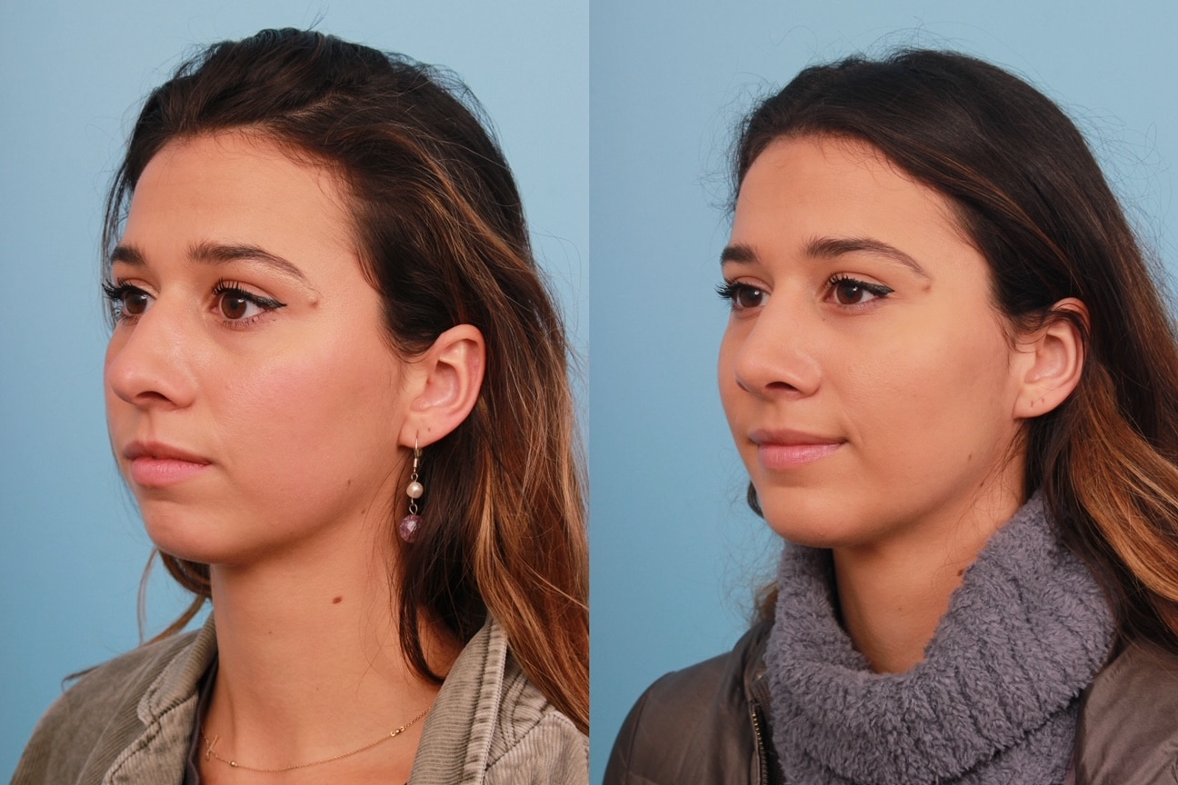 before_after_img