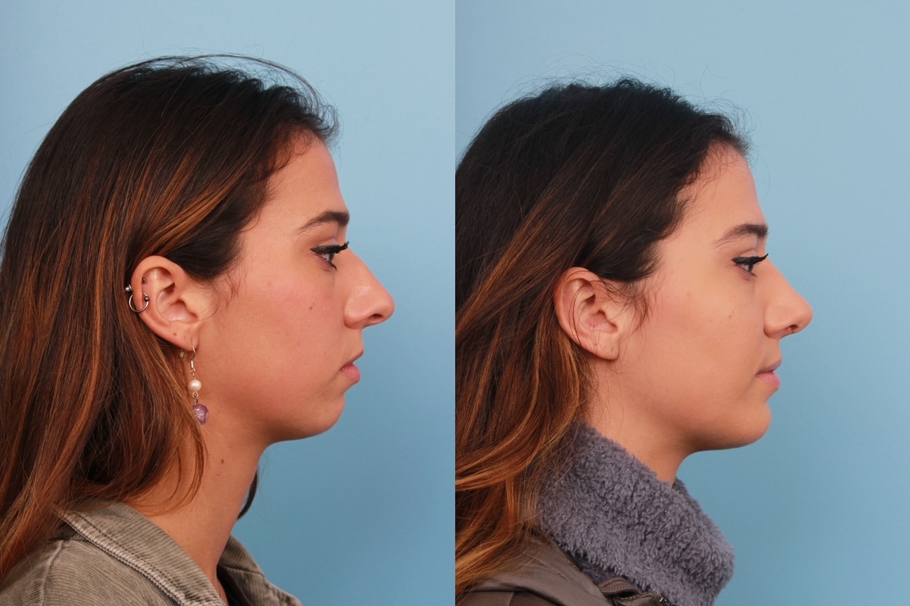 before_after_img