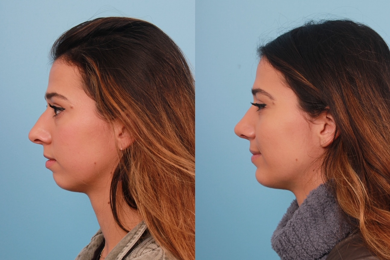 before_after_img