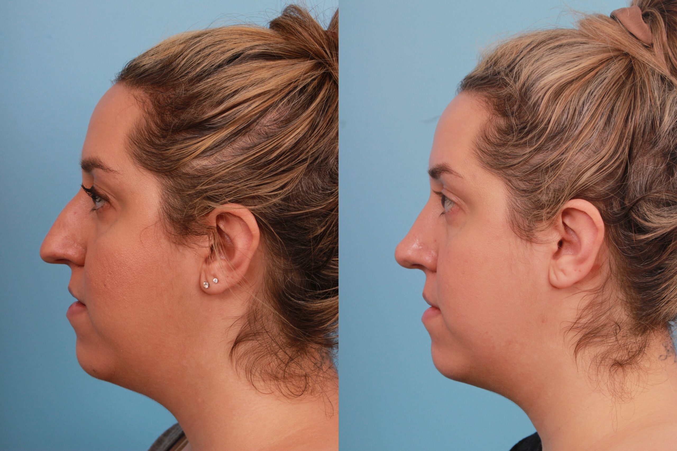 before_after_img