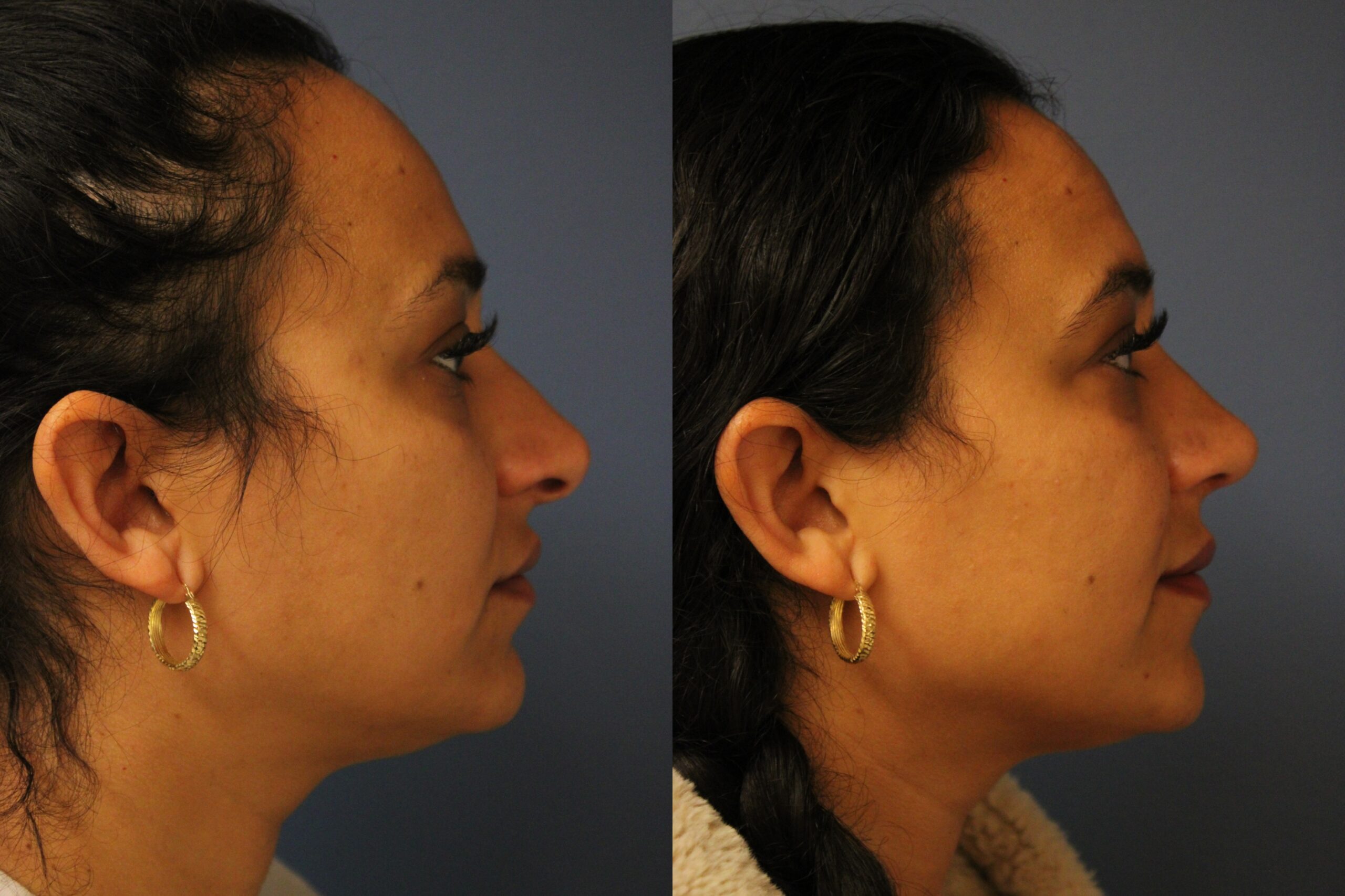 before_after_img