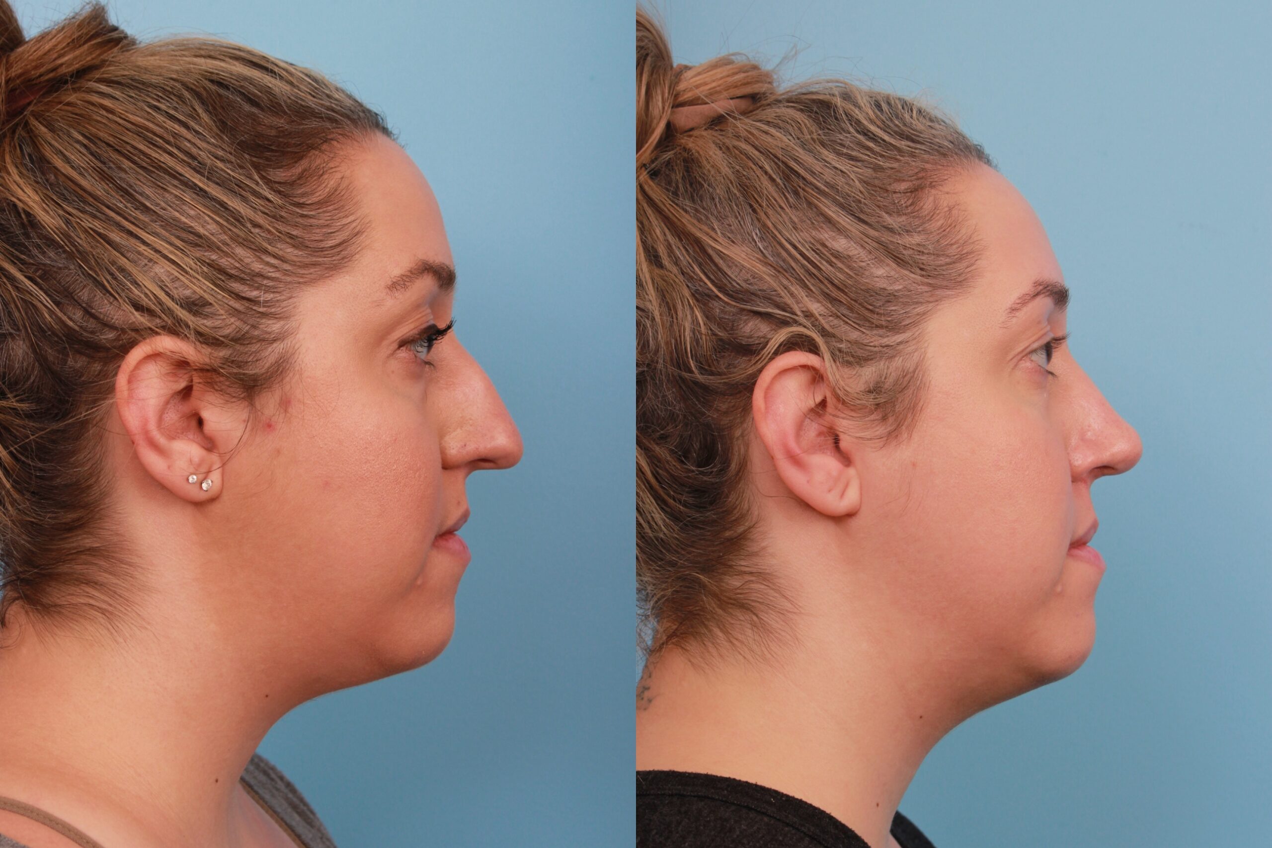 before_after_img
