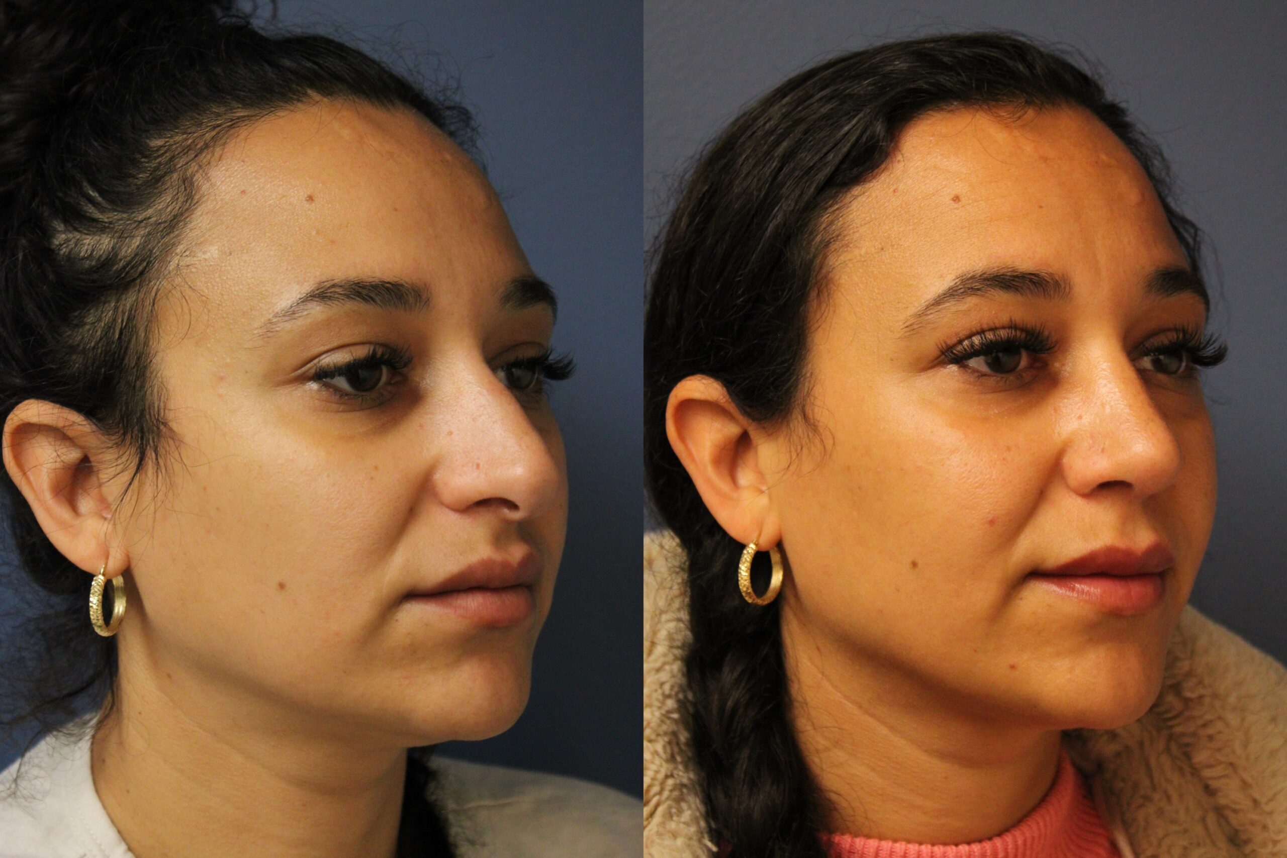 before_after_img