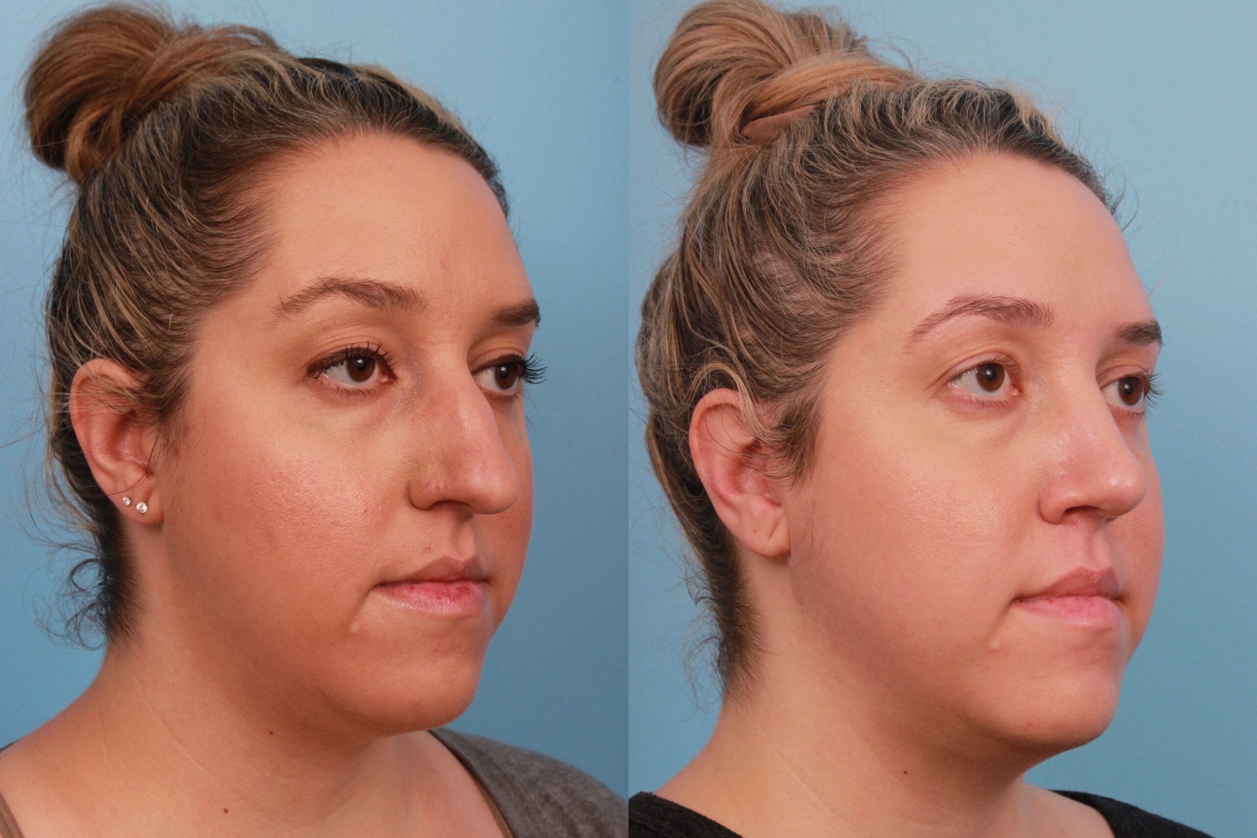 before_after_img
