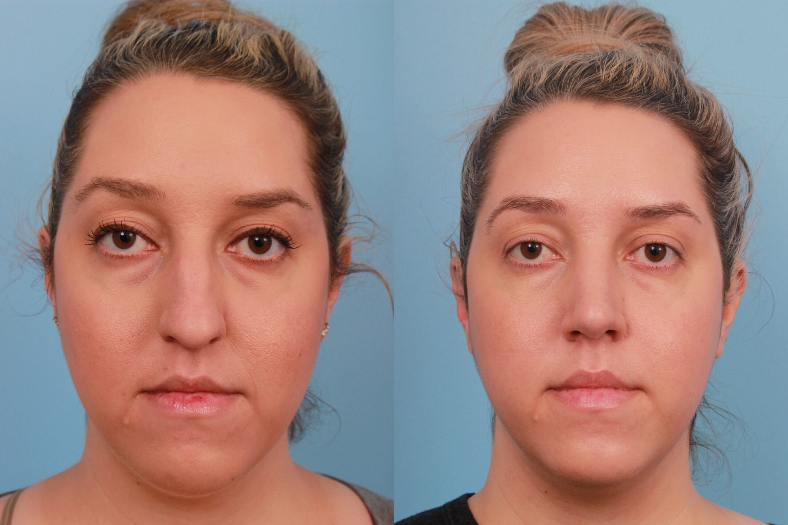 before_after_img