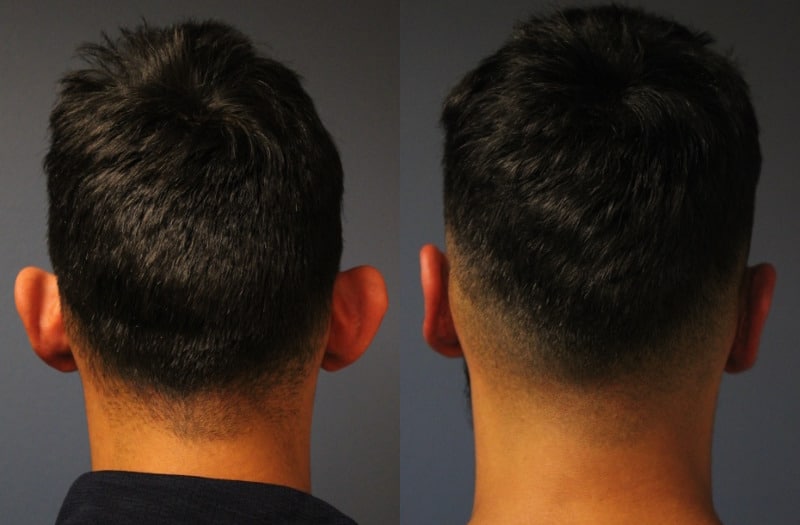 before_after_img