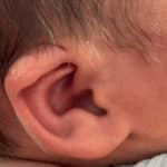 earwell-before-1