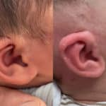 earwell-merged-1