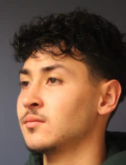 after rhinoplasty