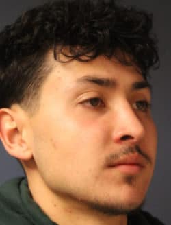 after rhinoplasty